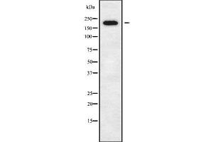 Western blot analysis of DOCK11 using K562 whole cell lysates (DOCK11 Antikörper  (Internal Region))