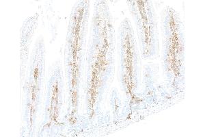 Immunohistochemistry (IHC) image for anti-CD48 (CD48) (AA 23-216) antibody (ABIN7795673)