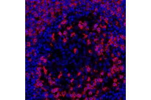 Immunofluorescence (IF) image for anti-CD45RO (CD45RO) antibody (ABIN7449553) (CD45RO Antikörper)