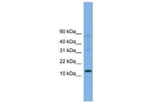 Western Blot showing CRABP2 antibody used at a concentration of 1-2 ug/ml to detect its target protein. (CRABP2 Antikörper  (Middle Region))