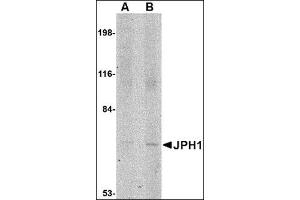 Western blot analysis of JPH1 in 293 cell lysate with this product at (A) 1 and (B) 2 μg/ml. (Junctophilin 1 Antikörper  (C-Term))