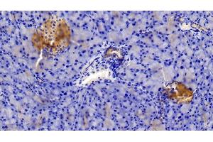 Immunohistochemistry (IHC) image for anti-Insulin Receptor (INSR) (AA 1101-1372) antibody (ABIN7438619)