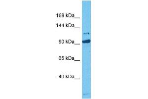 Host:  Rabbit  Target Name:  MORC3  Sample Tissue:  Human HCT116 Whole Cell  Antibody Dilution:  1ug/ml (MORC3 Antikörper  (C-Term))
