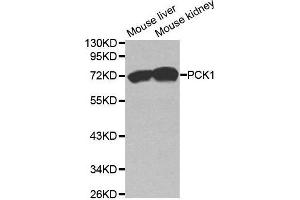 Western blot analysis of extracts of various cell lines, using PCK1 antibody. (PCK1 Antikörper  (C-Term))