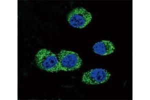 Confocal immunofluorescent analysis of RAGE antibody with MDA-MB231 cells followed by Alexa Fluor 488-conjugated goat anti-rabbit lgG (green).