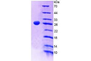 SDS-PAGE (SDS) image for Protein Tyrosine Phosphatase Receptor Type F (PTPRF) (AA 30-224) protein (His tag) (ABIN4989099)