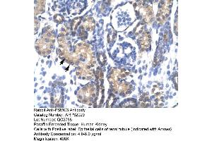 Human kidney (PSMC3 Antikörper  (Middle Region))