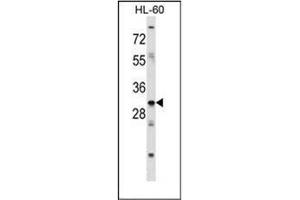 Western blot analysis of HOXB9 / HOX2E Antibody (Center) in HL-60 cell line lysates (35ug/lane). (HOXB9 Antikörper  (Middle Region))