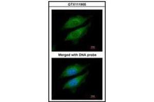 Immunofluorescence analysis of paraformaldehyde-fixed HeLa, using DPRP1 antibody at 1/200 dilution. (DPP8 Antikörper)