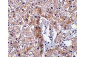 Immunohistochemical staining of human liver tissue using Casp12 small polyclonal antibody  at 10 ug/mL . (Caspase 12 Antikörper)