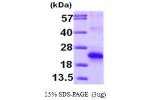 SDS-PAGE (SDS) image for Eukaryotic Translation Initiation Factor 5A2 (EIF5A2) (AA 1-153) protein (His tag) (ABIN667791)