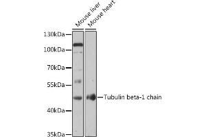 Western blot analysis of extracts of various cell lines, using Tubulin beta-1 chain antibody (ABIN7271046) at 1:1000 dilution. (TUBB1 Antikörper  (AA 362-451))