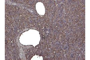 Immunohistochemistry (IHC) image for anti-Ionized Calcium-binding Adapter Molecule 1 (IBA1) (C-Term) antibody (ABIN184738)