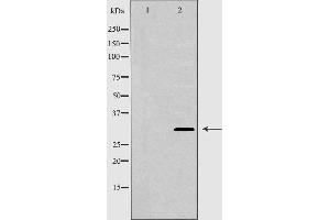 Western blot analysis of extracts of Mouse brain tissue lysate, using GJB3 antibody. (Connexin 31 Antikörper  (C-Term))