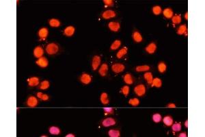 Immunofluorescence analysis of HeLa cells using XRCC1 Polyclonal Antibody at dilution of 1:100 (40x lens). (XRCC1 Antikörper)