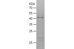 VNN2 Protein (AA 279-492) (His-IF2DI Tag)