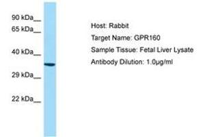 Image no. 1 for anti-G Protein-Coupled Receptor 160 (GPR160) (AA 40-89) antibody (ABIN6750006) (GPR160 Antikörper  (AA 40-89))
