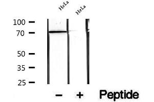 Western blot analysis of extracts of HeLa cells, using WDR46 antibody. (WDR46 Antikörper  (Internal Region))