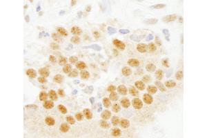 Immunohistochemistry (IHC) image for anti-SET Domain Containing 8 Pseudogene 1 (SETD8P1) (AA 316-366) antibody (ABIN7454780)
