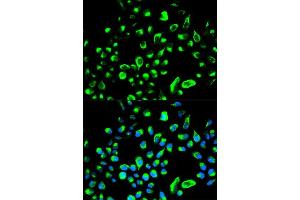 Immunofluorescence analysis of HeLa cell using YWHAQ antibody. (14-3-3 theta Antikörper  (AA 1-245))