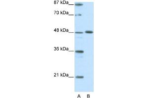 WB Suggested Anti-ZNF259 Antibody Titration:  0. (ZNF259 Antikörper  (C-Term))