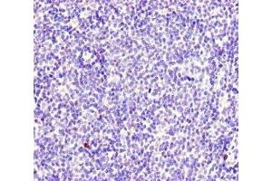 Immunohistochemistry of paraffin-embedded human lymph node tissue using ABIN7174949 at dilution of 1:100 (MYO1G Antikörper  (AA 209-389))