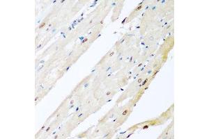 Immunohistochemistry (Paraffin-embedded Sections) (IHC (p)) image for anti-Valosin Containing Protein (VCP) (AA 647-806) antibody (ABIN6150072)