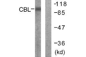 Immunohistochemistry analysis of paraffin-embedded human breast carcinoma tissue using CBL (Ab-700) antibody. (CBL Antikörper  (Tyr700))