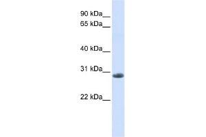 YIPF6 antibody used at 1 ug/ml to detect target protein. (YIPF6 Antikörper  (C-Term))