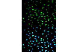 Immunofluorescence analysis of MCF-7 cells using STK11 antibody. (LKB1 Antikörper)
