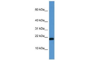 WB Suggested Anti-SH2D1A Antibody Titration: 0. (SH2D1A Antikörper  (C-Term))
