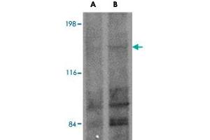 Western blot analysis of FRMPD1 in K-562 cell lysate with FRMPD1 polyclonal antibody  at (A) 1 and (B) 2 ug/mL . (FRMPD1 Antikörper  (C-Term))