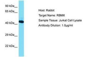 Image no. 1 for anti-RNA Binding Motif Protein, X-Linked (RBMX) (AA 210-259) antibody (ABIN6750464) (RBMX Antikörper  (AA 210-259))