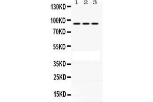 Anti-PRLR Picoband antibody, Western blotting All lanes: Anti PRLR  at 0.
