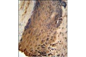 GFPT2 Antibody (Center) (ABIN653230 and ABIN2842763) IHC analysis in formalin fixed and paraffin embedded human skin followed by peroxidase conjugation of the secondary antibody and DAB staining. (GFPT2 Antikörper  (AA 175-201))