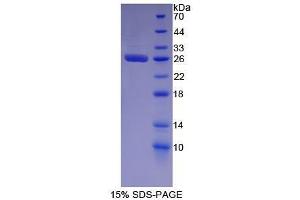 SDS-PAGE (SDS) image for Glutathione S-Transferase alpha 2 (GSTa2) (AA 1-222) protein (His tag) (ABIN1079683) (GSTa2 Protein (AA 1-222) (His tag))