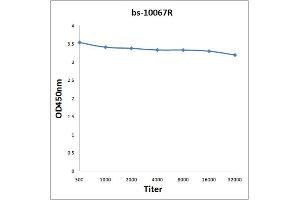 Antigen: 0. (ROR1 Antikörper  (AA 301-360))