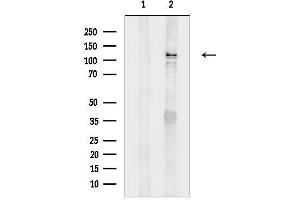 anti-Intercellular Adhesion Molecule 3 (ICAM3) (Internal Region) antibody