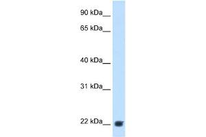 WB Suggested Anti-KLKB1 Antibody Titration:  2. (KLKB1 Antikörper  (Middle Region))