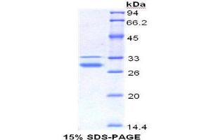 SDS-PAGE (SDS) image for High Mobility Group Box 1 (HMGB1) (AA 1-215) protein (His tag) (ABIN1079868)