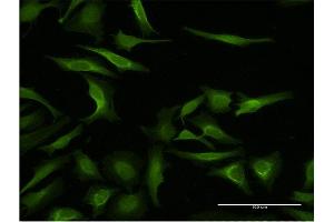Immunofluorescence of monoclonal antibody to MAGEA3 on HeLa cell. (MAGEA3 Antikörper  (AA 44-114))