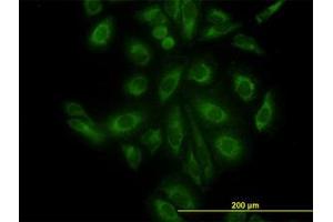 Image no. 3 for anti-ARP3 Actin-Related Protein 3 (ACTR3) (AA 1-419) antibody (ABIN599115) (ACTR3 Antikörper  (AA 1-419))