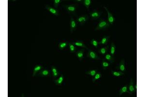 Immunofluorescence analysis of A549 cells using APEX1 antibody (ABIN5970467). (APEX1 Antikörper)