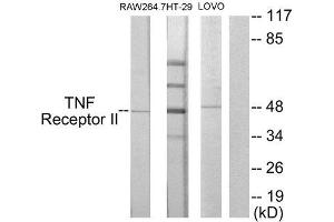 Western Blotting (WB) image for anti-Tumor Necrosis Factor Receptor Superfamily, Member 1B (TNFRSF1B) (C-Term) antibody (ABIN1849234) (TNFRSF1B Antikörper  (C-Term))