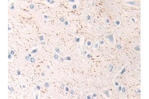 Detection of MAP2K1 in Human Cerebrum Tissue using Polyclonal Antibody to Mitogen Activated Protein Kinase Kinase 1 (MAP2K1) (MEK1 Antikörper  (AA 54-369))