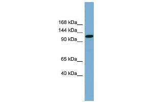 SLC12A5 antibody used at 1 ug/ml to detect target protein.