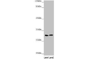 Western blot All lanes: SNAP29 antibody at 1. (SNAP29 Antikörper  (AA 1-258))