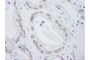 Immunohistochemistry (IHC) image for anti-DEAD (Asp-Glu-Ala-Asp) Box Polypeptide 24 (DDX24) (C-Term) antibody (ABIN7448518) (DDX24 Antikörper  (C-Term))