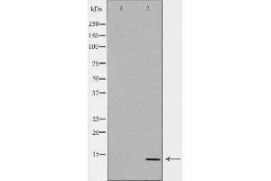 Western blot analysis of JAR  lysate using CGA antibody. (CGA Antikörper  (Internal Region))