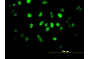 Immunofluorescence of monoclonal antibody to HIF1AN on HeLa cell. (HIF1AN Antikörper  (AA 1-349))